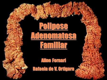 Polipose Adenomatosa Familiar Aline Fornari Rafaela de V. Ortigara.