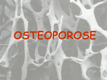 OSTEOPOROSE.