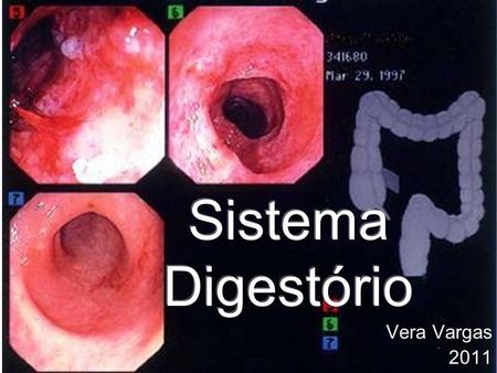 Sistema Digestório Vera Vargas 2011.