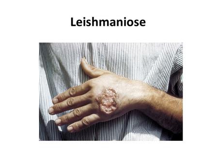 Leishmaniose.