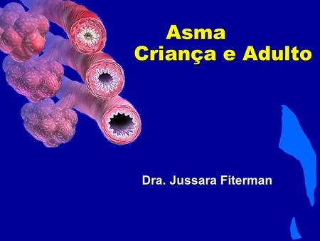 Asma Criança e Adulto Dra. Jussara Fiterman. Objetivos da apresentação 1.Abordagem dos fenótipos da asma 2.Exposição dos recentes dados dos maiores estudos.