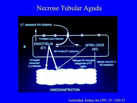 Necrose Tubular Aguda Lieberthal. Kidney Int 1997; 52: 1102-15.