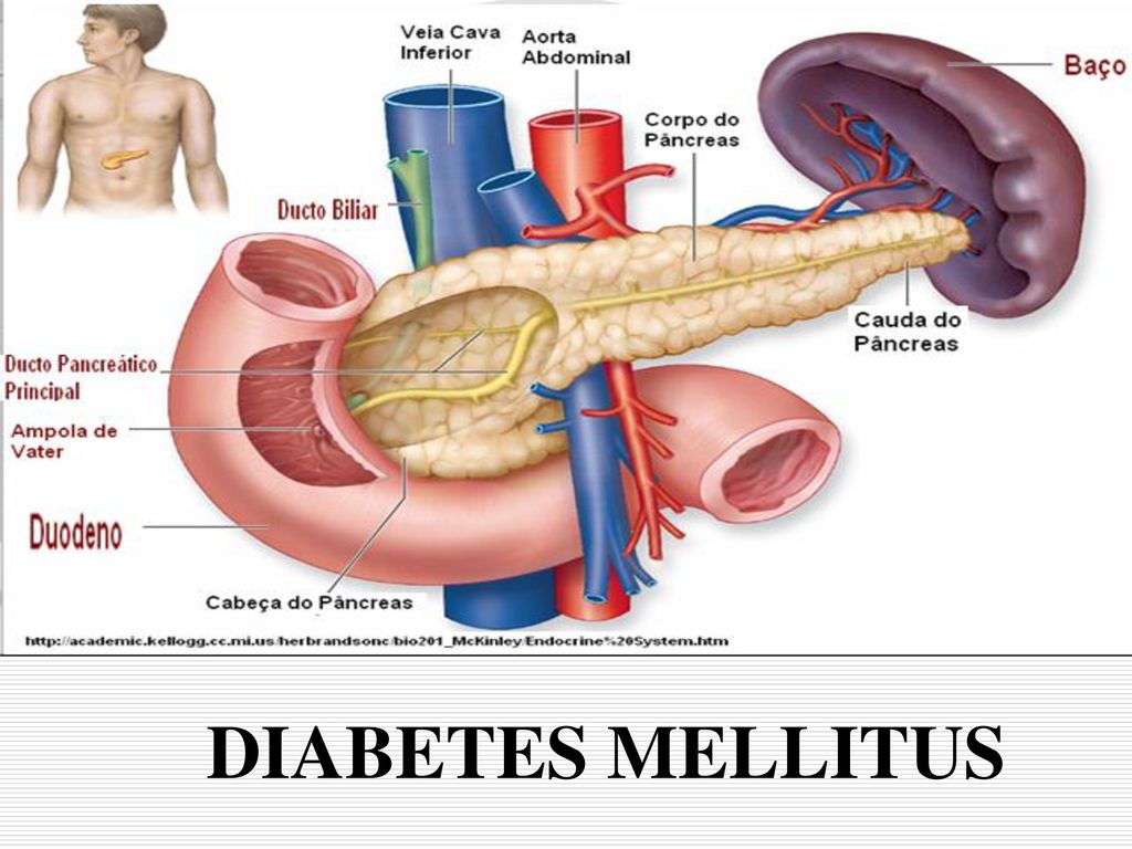 a diabetes mellitus kezelése, amikor súlyosbítva pancreatitis