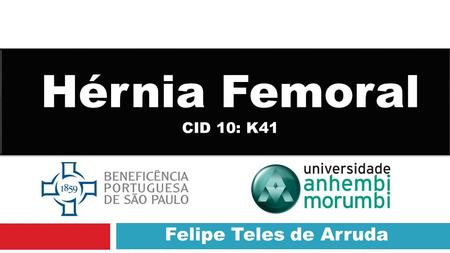 Hérnia Femoral CID 10: K41 Felipe Teles de Arruda.