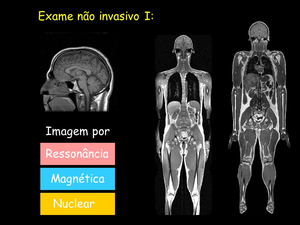 Ressonância magnética nuclear