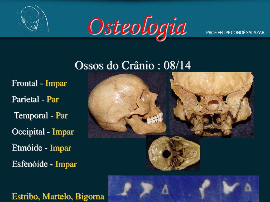 Osteologia Ossos do Crânio : 08/14 Frontal - Impar Parietal - Par - ppt  carregar