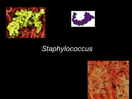 Staphylococcus.