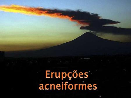 Erupções acneiformes.