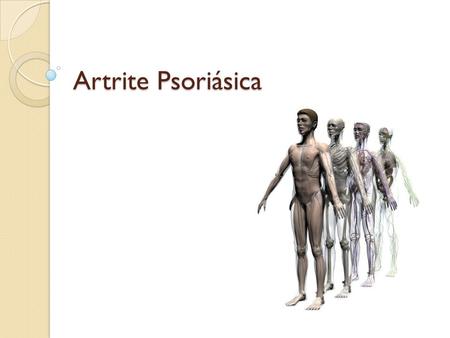 Artrite Psoriásica.