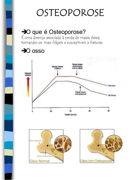 OSTEOPOROSE O que é Osteoporose? O osso