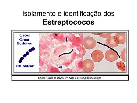 Isolamento e identificação dos Estreptococos