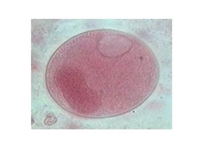 A balantidiose é uma protozoose, ou seja, uma doença transmissível causada por protozoários. O responsável por tal moléstia é chamado Balantidium coli,