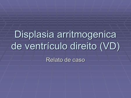 Displasia arritmogenica de ventrículo direito (VD)