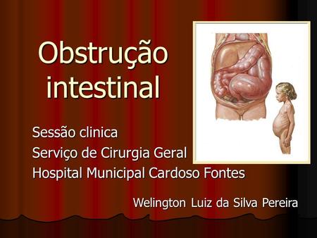 Obstrução intestinal Sessão clinica Serviço de Cirurgia Geral