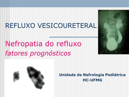 REFLUXO VESICOURETERAL Nefropatia do refluxo fatores prognósticos