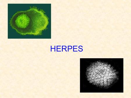 HERPES.