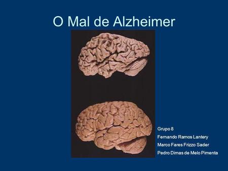 O Mal de Alzheimer Grupo 8 Fernando Ramos Lantery