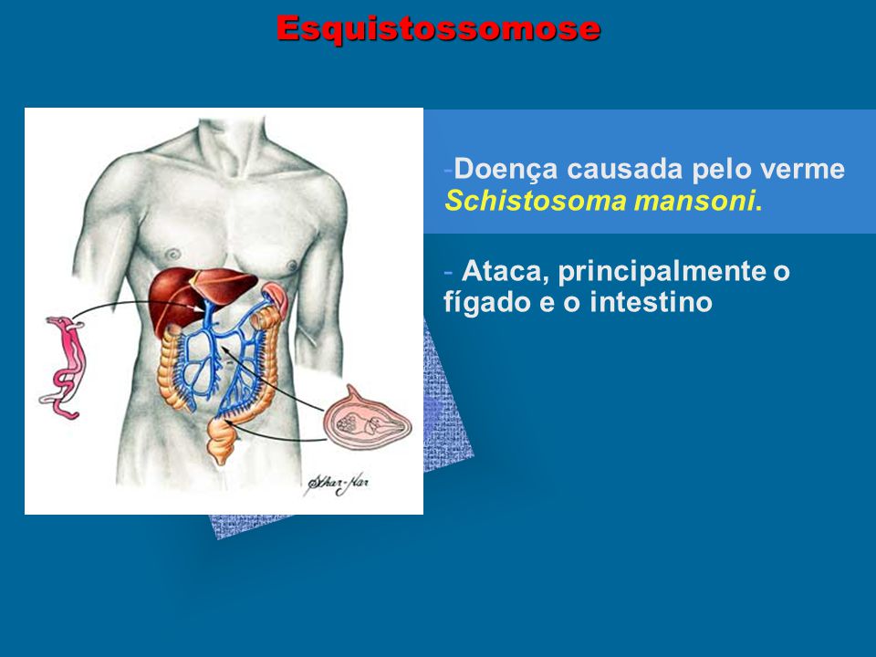 Esquistossomose Doenca Causada Pelo Verme Schistosoma Mansoni Ppt Carregar