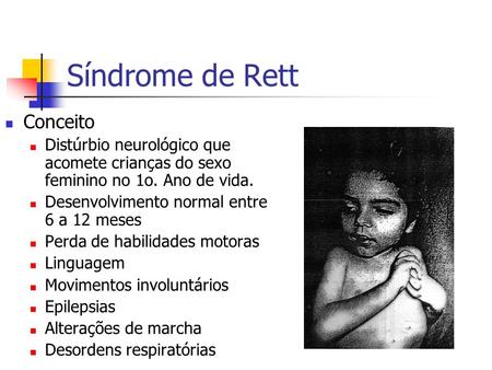Síndrome de Rett Conceito Distúrbio neurológico que acomete crianças do sexo feminino no 1o. Ano de vida. Desenvolvimento normal entre 6 a 12 meses Perda.