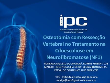 Osteotomia com Ressecção Vertebral no Tratamento na Cifoescoliose em Neurofibromatose (NF1) RODRIGO AUGUSTO DO AMARAL 1, RUBENS JENSEN 1, LUIS MARCHI 1,