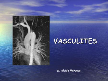 VASCULITES M. Alcide Marques.