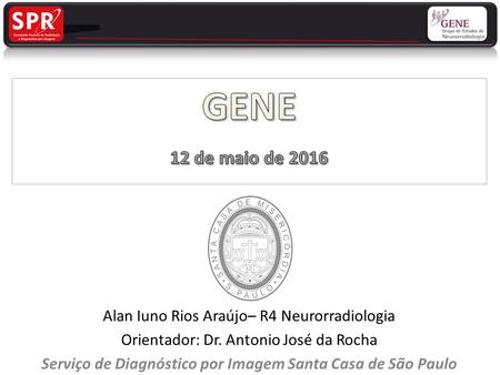 Alan Iuno Rios Araújo– R4 Neurorradiologia Orientador: Dr. Antonio José da Rocha Serviço de Diagnóstico por Imagem Santa Casa de São Paulo.