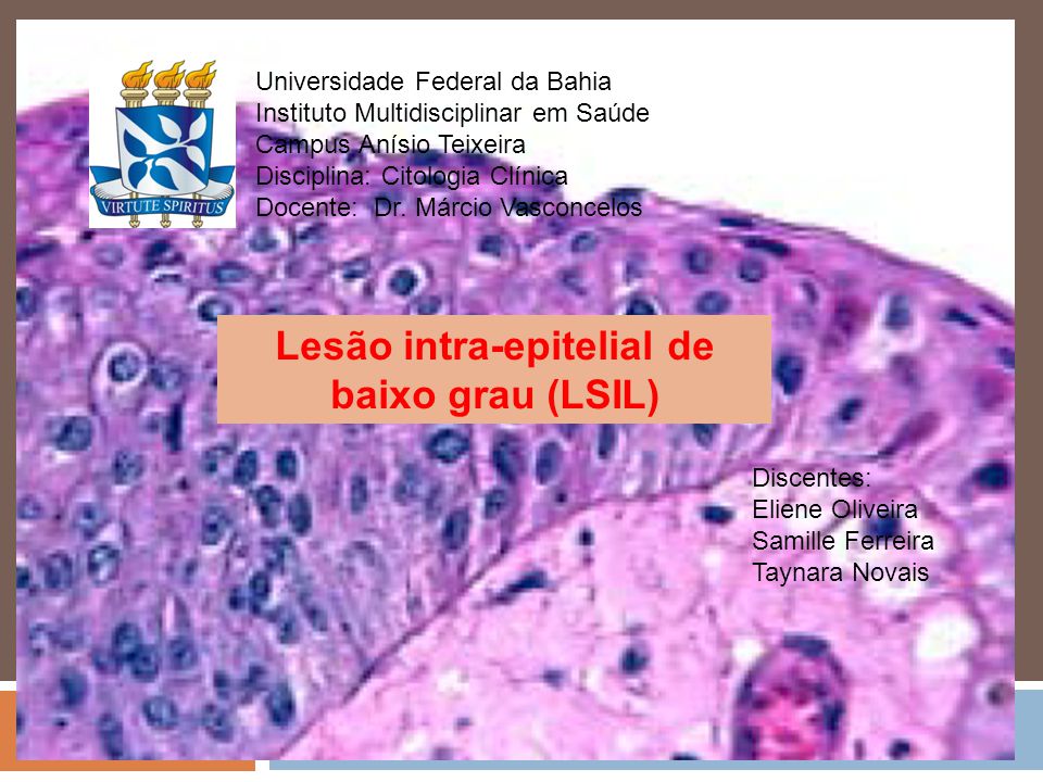 Lesão intra-epitelial de baixo grau (LSIL) - ppt video online carregar