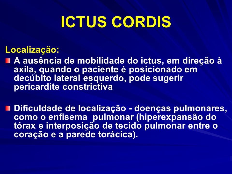 O Que é Ictus Cordis - BRAINCP