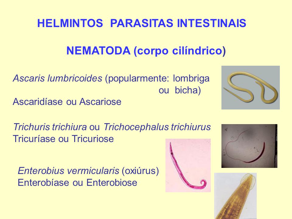 aszcariasis parazita
