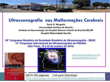 Ultrassonografia nas Malformações Cerebrais Paulo R