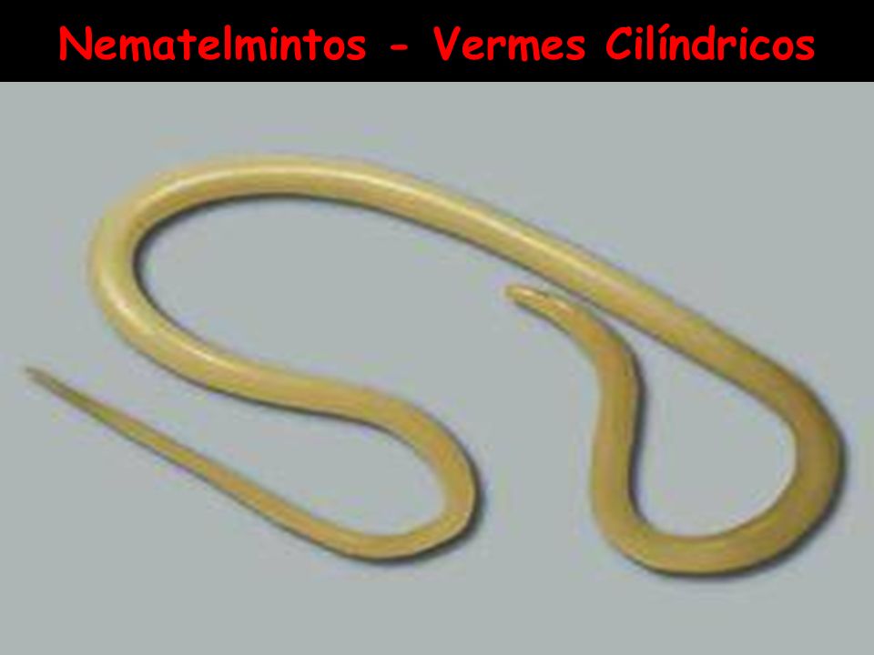 filo nemathelminthes vermes cylindricos