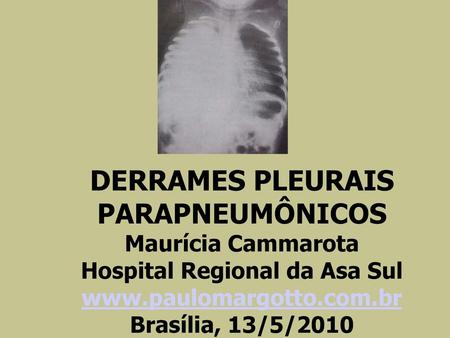 DERRAMES PLEURAIS PARAPNEUMÔNICOS Maurícia Cammarota Hospital Regional da Asa Sul www.paulomargotto.com.br Brasília, 13/5/2010.