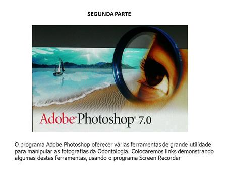 SEGUNDA PARTE O programa Adobe Photoshop oferecer várias ferramentas de grande utilidade para manipular as fotografias da Odontologia. Colocaremos links.