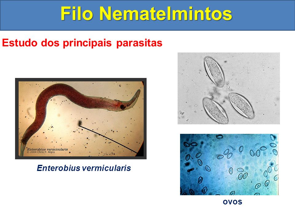 enterobius vermicularis filo