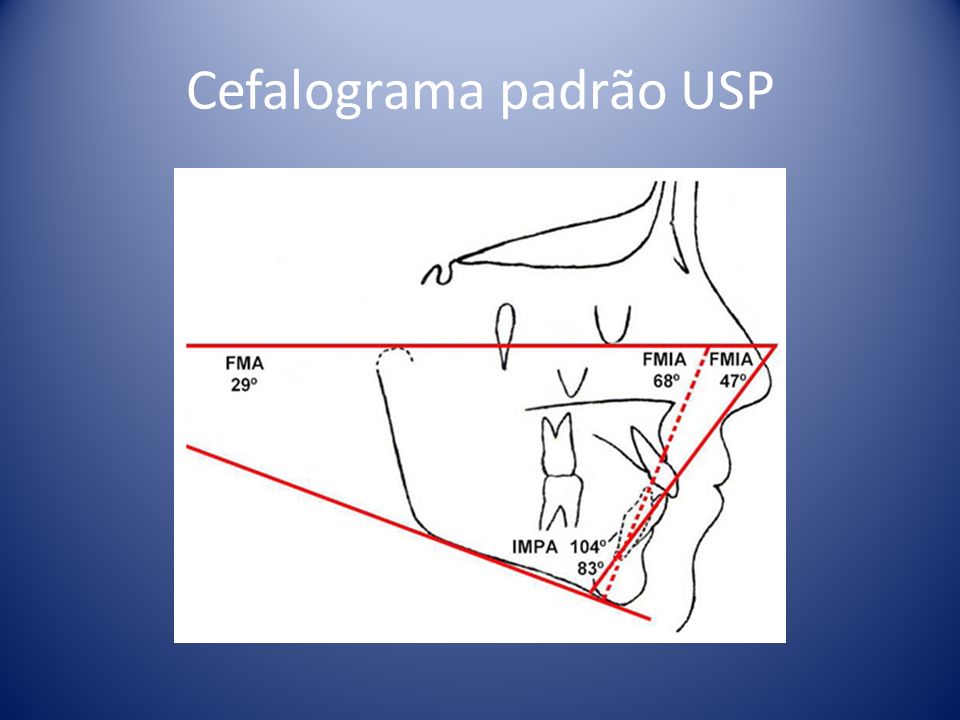 Cefalograma padrão USP