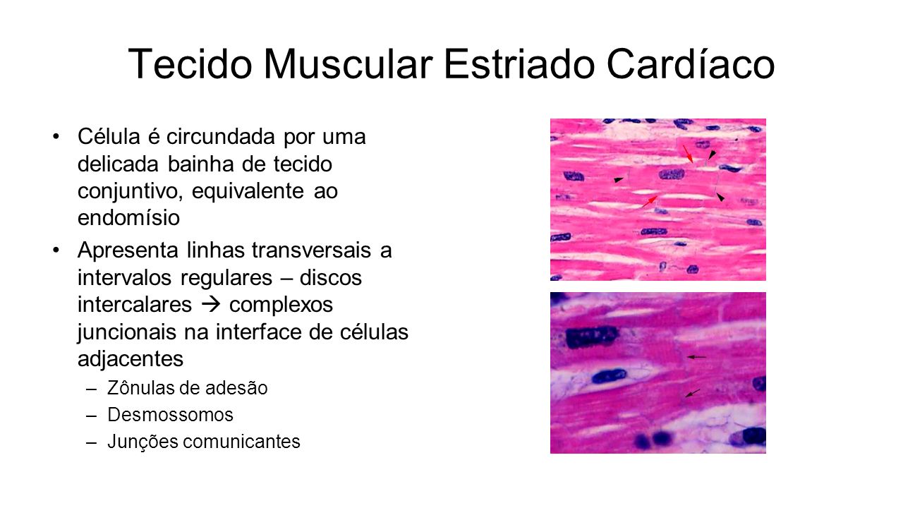 Histologia do Tecido Muscular - ppt carregar