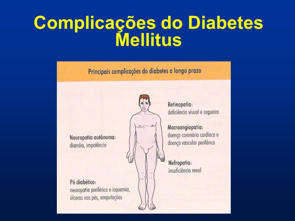 neuropathia kezelésére diabetes mellitus 2 típusok