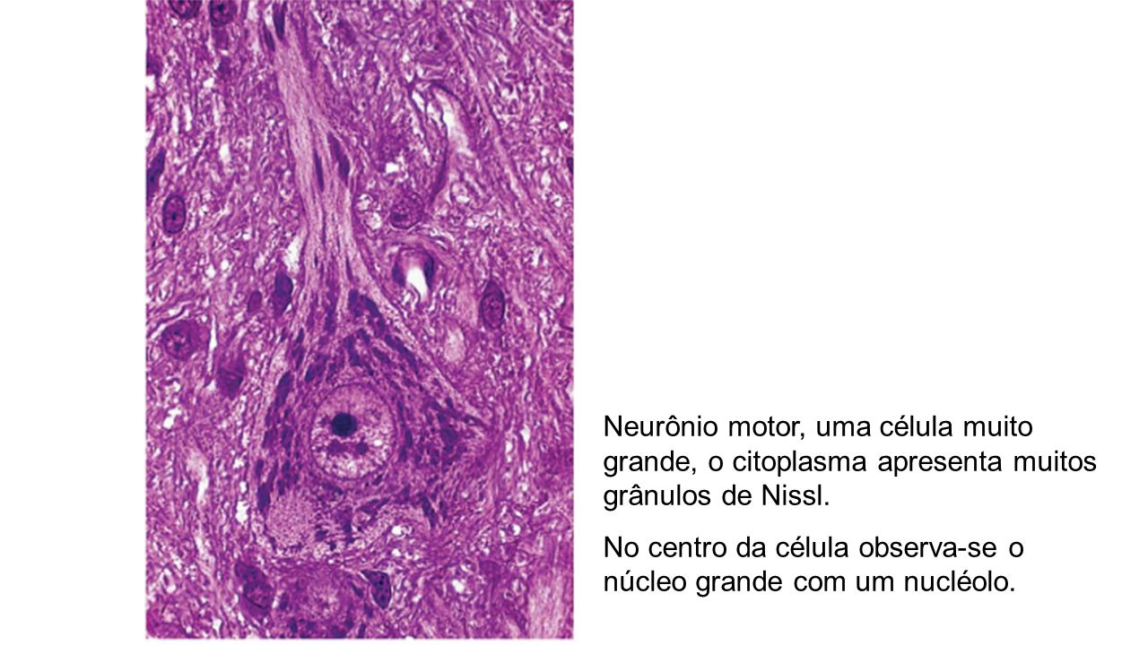 Neurônio motor, uma célula muito grande, o citoplasma apresenta muitos grânulos de Nissl.