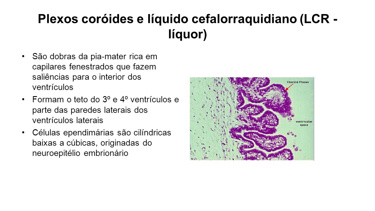 Plexos coróides e líquido cefalorraquidiano (LCR - líquor)