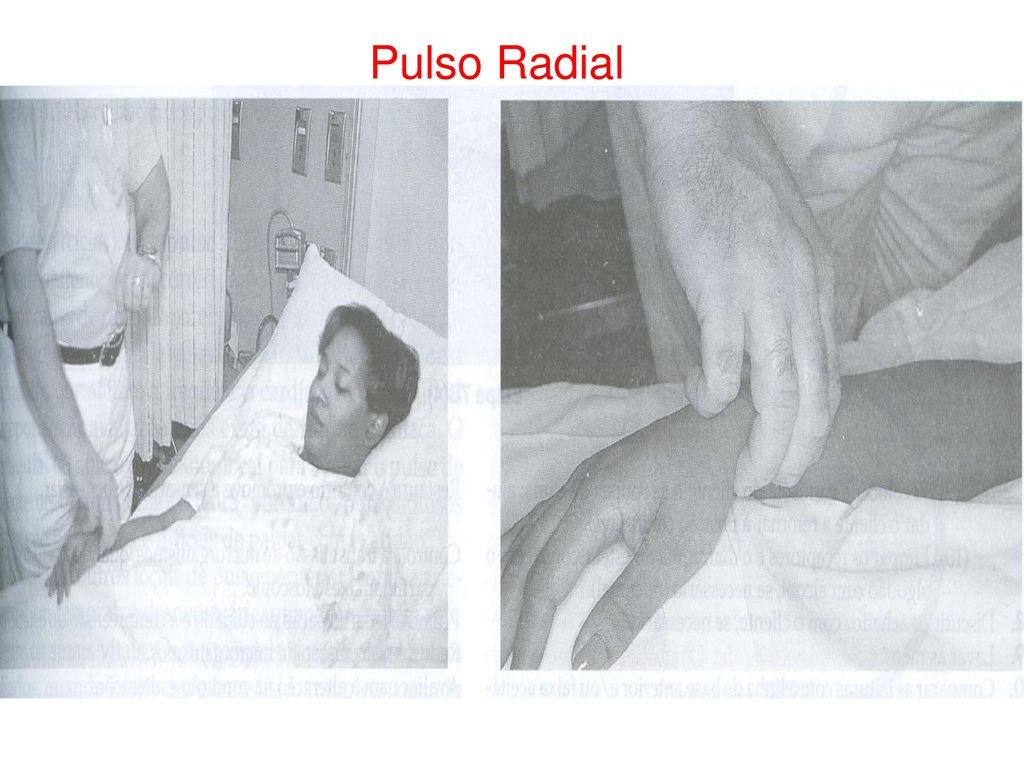 Pulso Radial