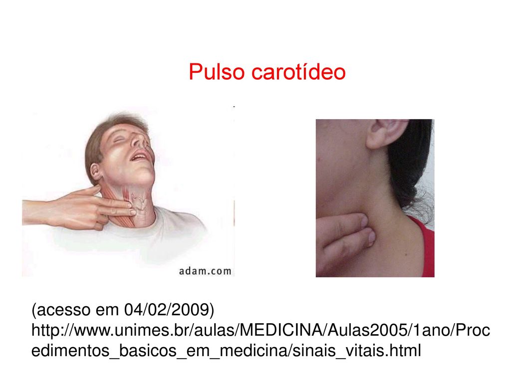Pulso carotídeo (acesso em 04/02/2009)   edimentos_basicos_em_medicina/sinais_vitais.html.