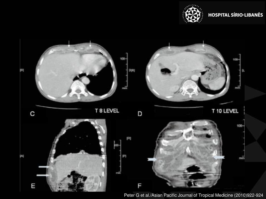 Peter G et al./Asian Pacific Journal of Tropical Medicine (2010)