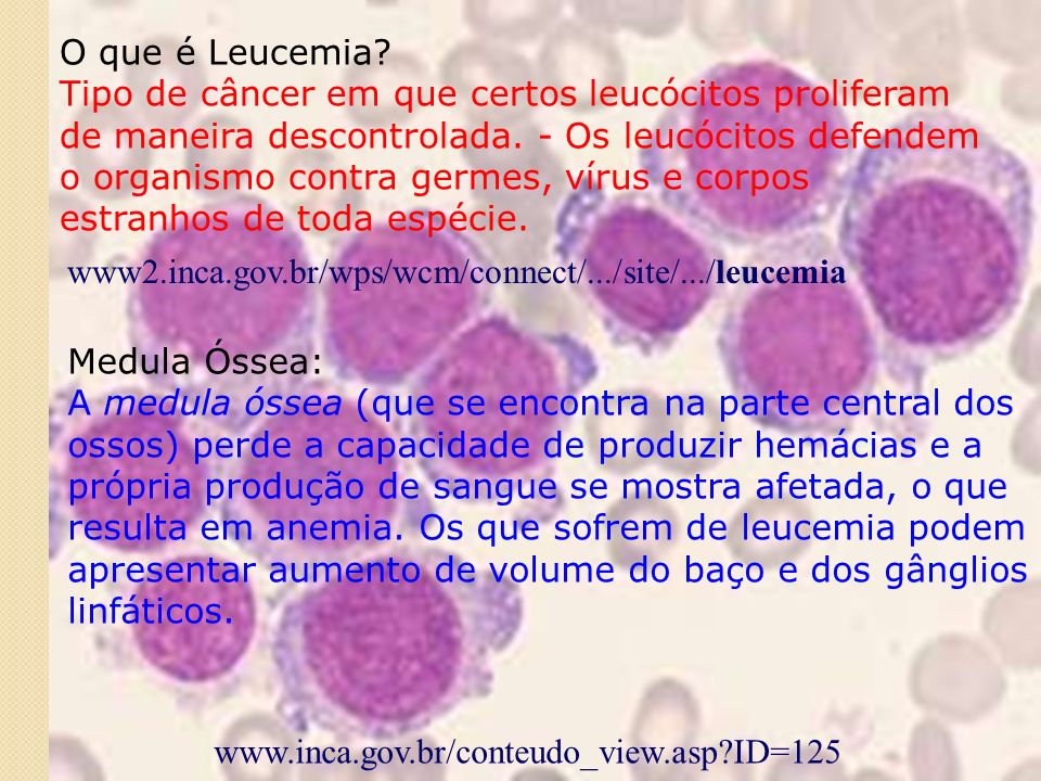 anemia x leucemia)