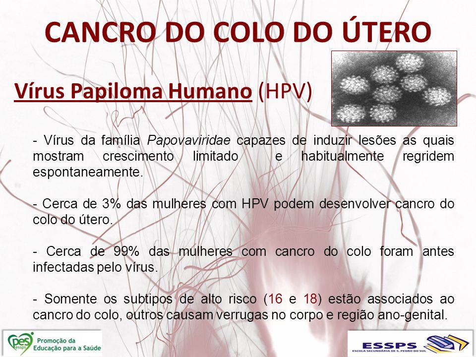 Vírus Papiloma Humano (HPV)