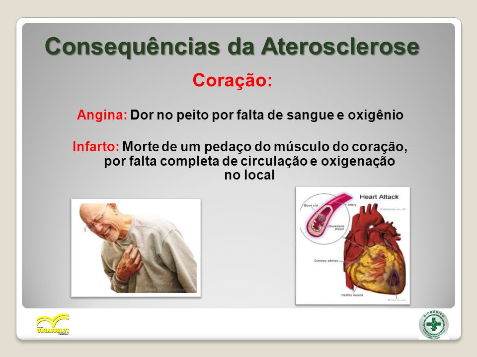 Consequências da Aterosclerose