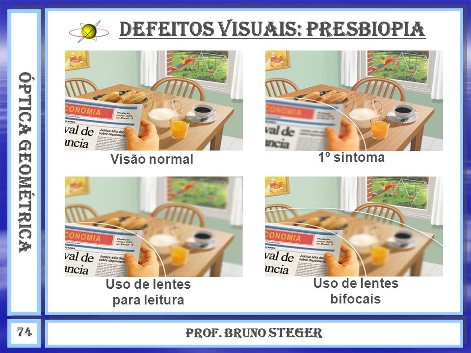 Defeitos visuais: Presbiopia Uso de lentes para leitura