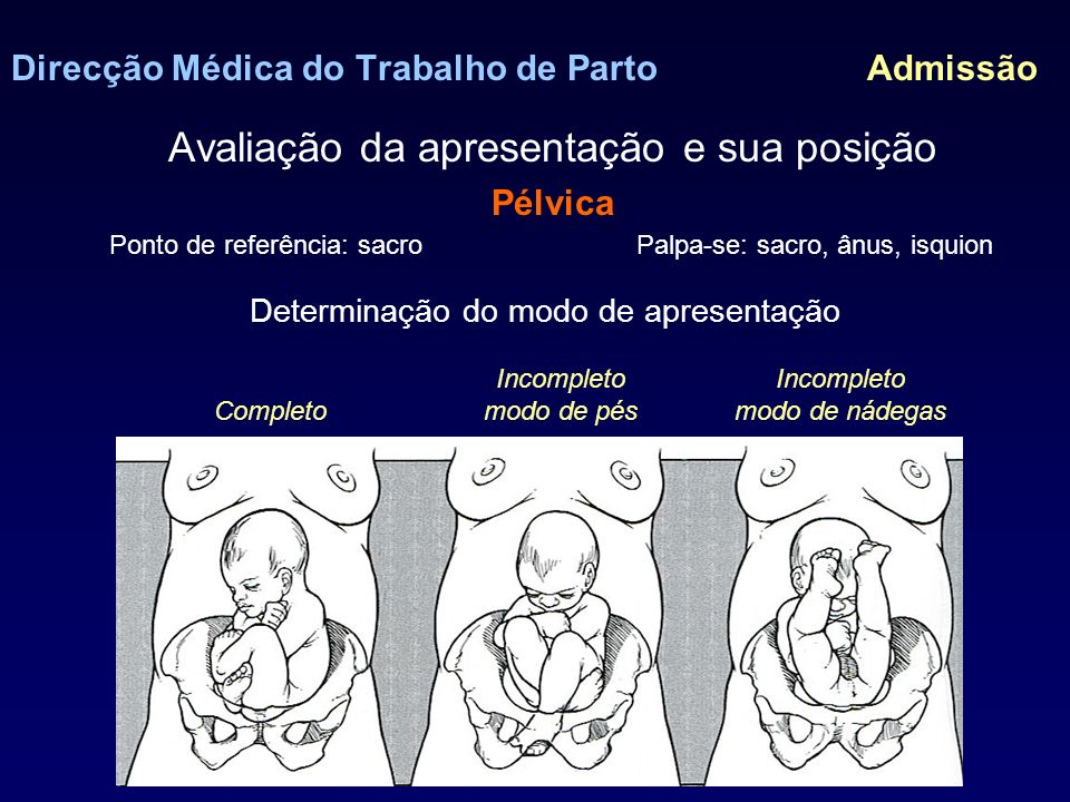Mecanismo de parto e assistência clínica ao parto Direc%C3%A7%C3%A3o+M%C3%A9dica+do+Trabalho+de+Parto+Admiss%C3%A3o