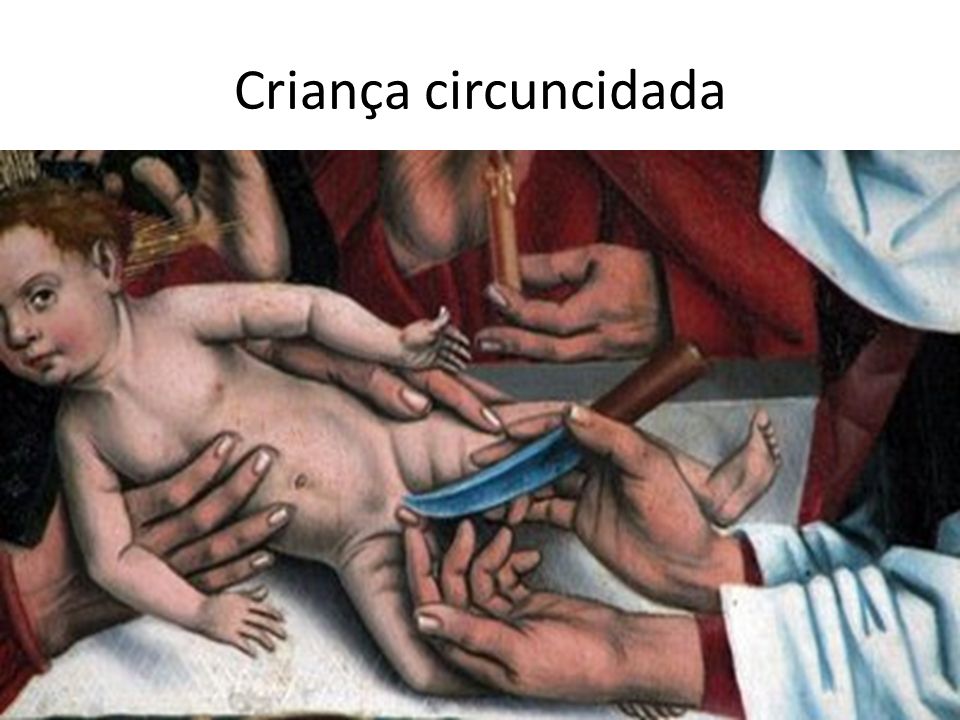 Criança circuncidada