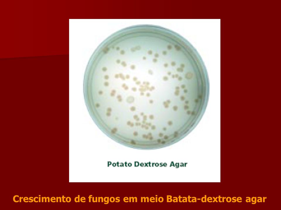 Crescimento de fungos em meio Batata-dextrose agar