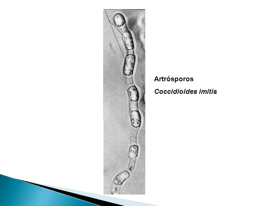 Artrósporos Coccidioides imitis